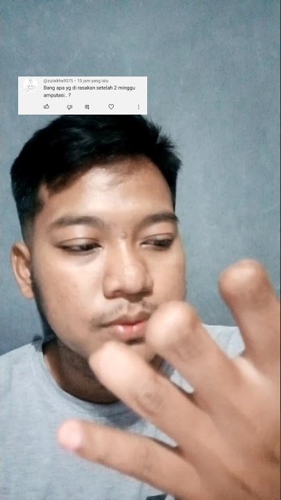 Rasanya setelah 2 minggu jari tangan putus diamputasi #shortsvideo