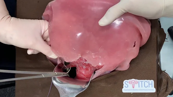 STITCH Trainer: Uterine Artery Ligation Short