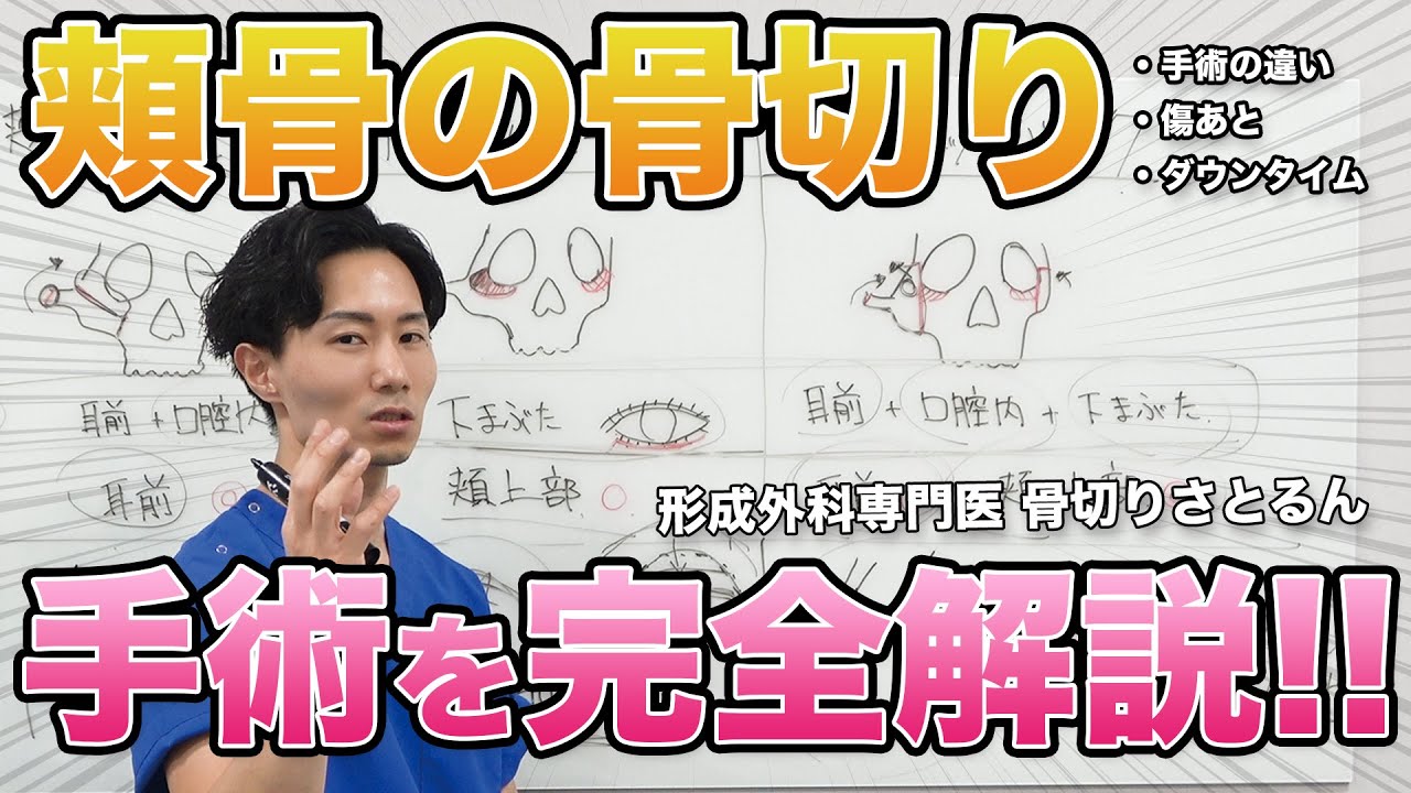 【小顔】気になる頬の出っ張りを改善!頬骨の骨切りの手術の違いは?完全解説!【アマソラクリニック】