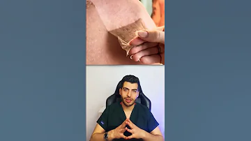 حرق الشمس حروق حروق الليزر حروق البشرة تقشير البشرة تقشير الجسم د مصعب حسوا ثقف نفسك طبيا 