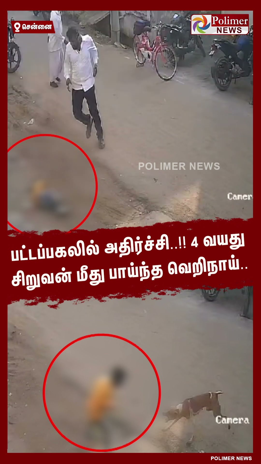 பட்டப்பகலில் அதிர்ச்சி..!!  4 வயது சிறுவன் மீது பாய்ந்த வெறிநாய்.. #shorts