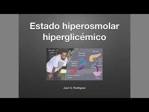 Vídeo: Diferencia Entre Calzoncillos De Hombre De Tiro Bajo Y Alto