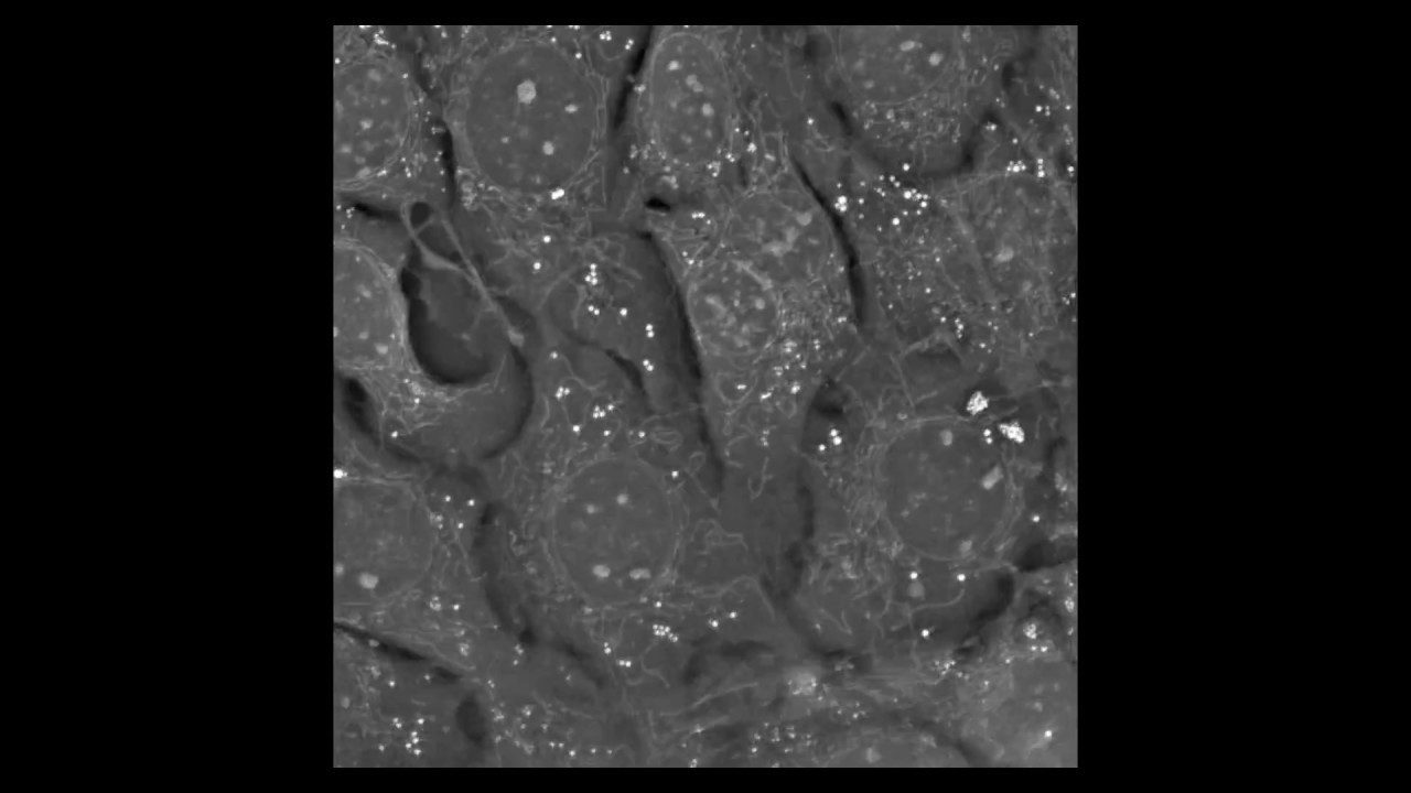 Live imaging of mouse pre adipocytes for 48 hours