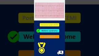 Medical Quiz (ECG)