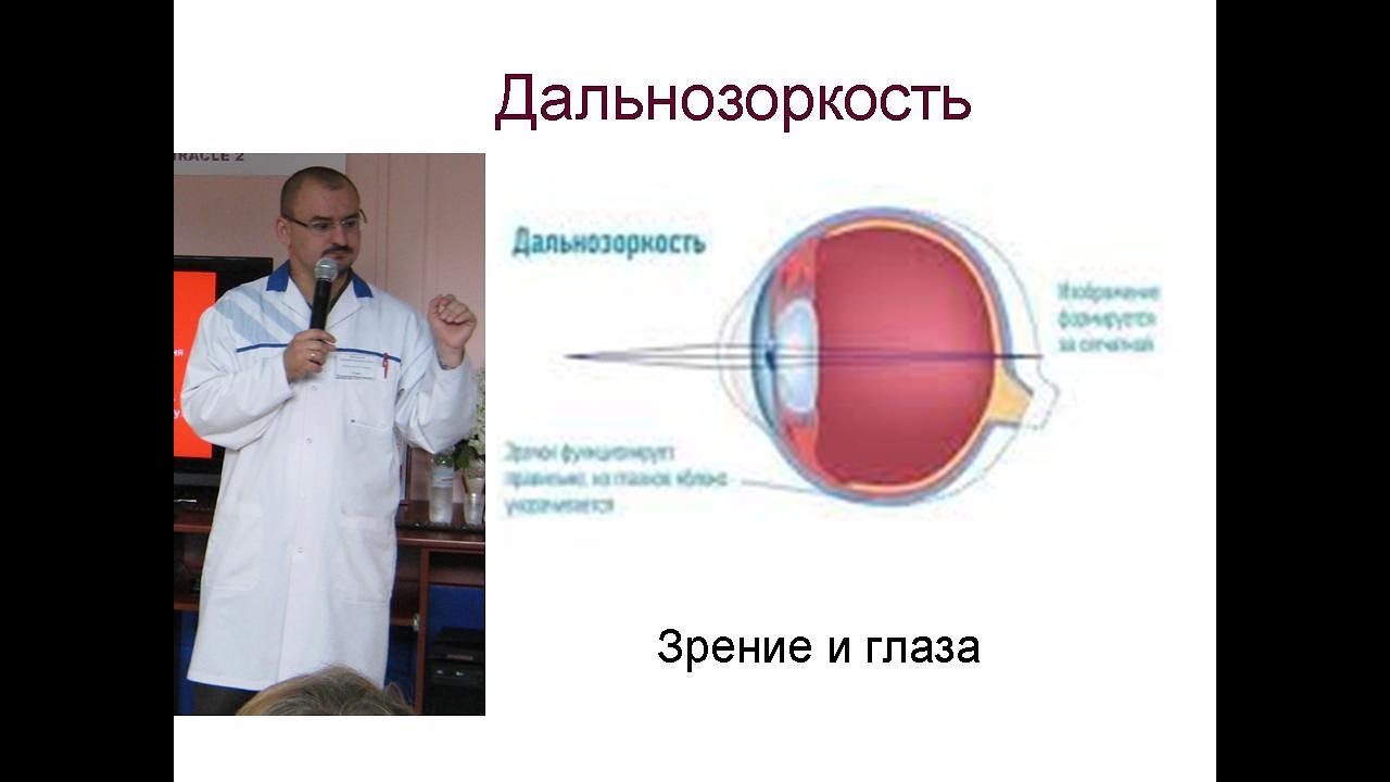 Дальнозоркость. Пресбиопия. Плюсовые очки. - YouTube