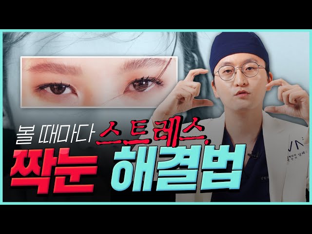 [VN TV] #짝눈교정 가능? 불가능?? #성형외과전문의 #김태훈 원장