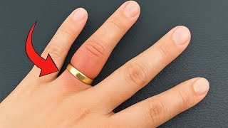 Many People Dont Know This Trick To Remove A Stuck Ring