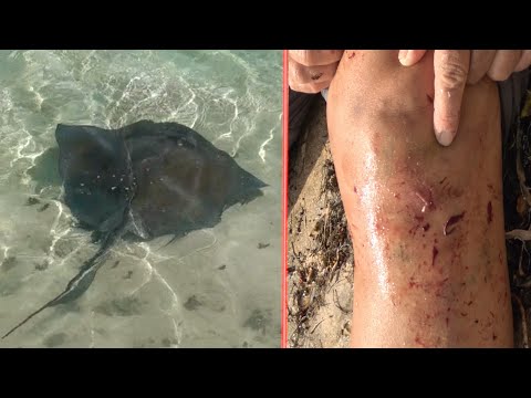 Stingrays Attack! How safe is it to swim with stingrays?