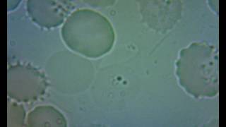 Lyme under the microscope 1
