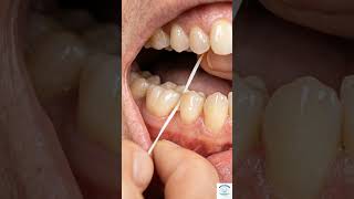Flossing Importance of Teeth #Flossing #DentalCare#TeethCleaning #HealthySmile#OralHygiene #dentist