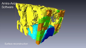 Image processing & quantification: Tissue texture separation with Amira Software