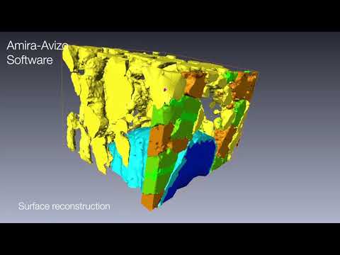 Image processing & quantification: Tissue texture separation with Amira Software