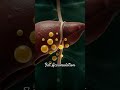 🚨 Mistakes That Could Make Fatty Liver Worse Without You Realizing It