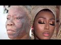 MUST WATCH 👆👆 FULL COVERAGE FOUNDATION MAKEUP TRANSFORMATION ON BLEMISH SKIN