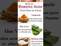 Remove acne at home #shorts #viralshorts #acnetreatment