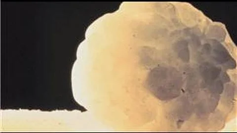 Environmental Science & Weather : How Does Hail Form?