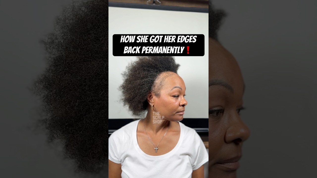 How She Got Her Edges Back Permanently Without Surgery Or Pills/Oils/Shots😱