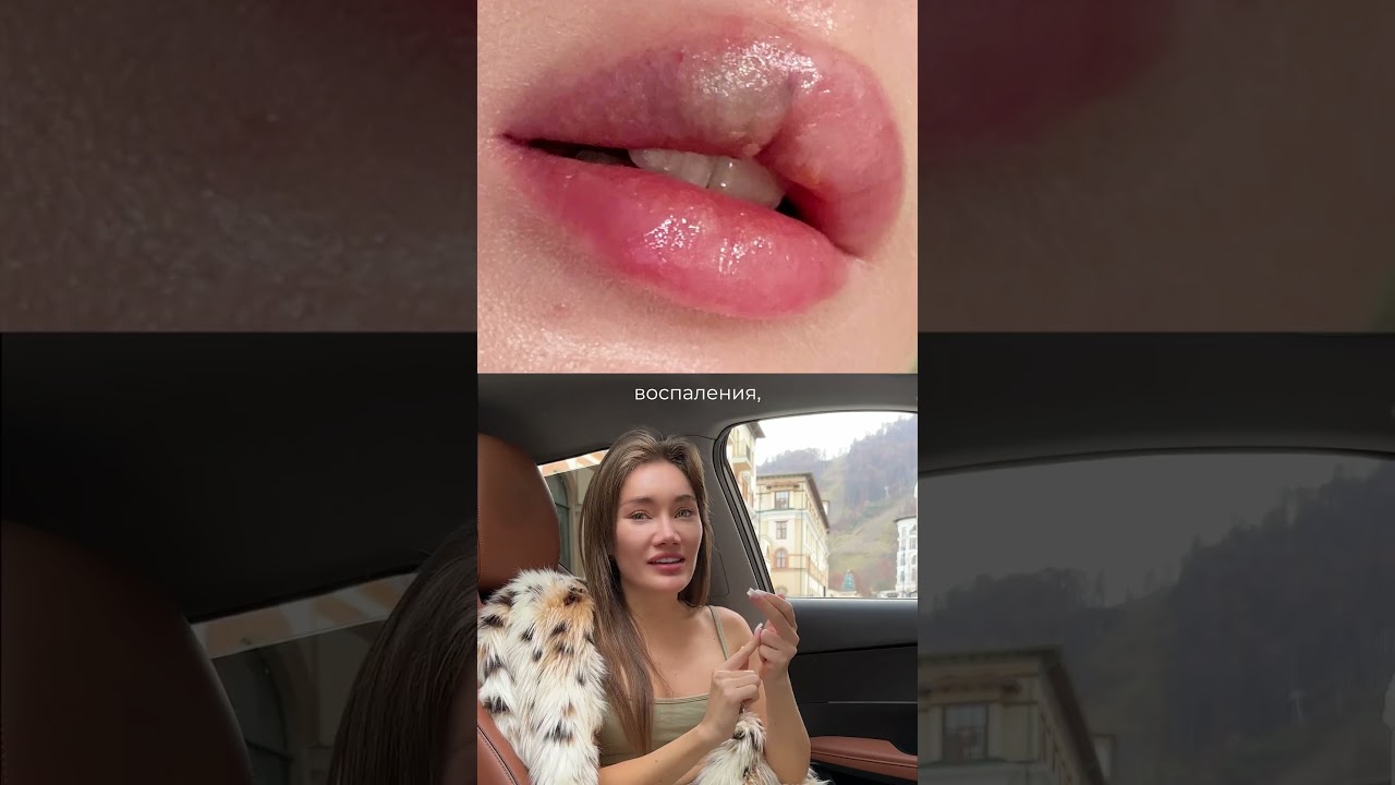 Оригинальный филлер невозможно купить, если ты не врач. 