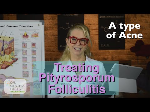 Video: Pityrosporum Folliculitis: Natuurlijke Behandeling, Gezicht En Meer