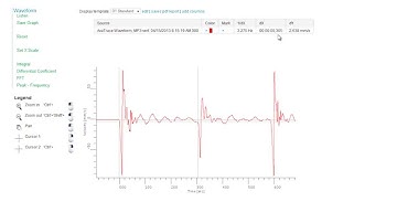 AvaNet Triax and Waveform Report