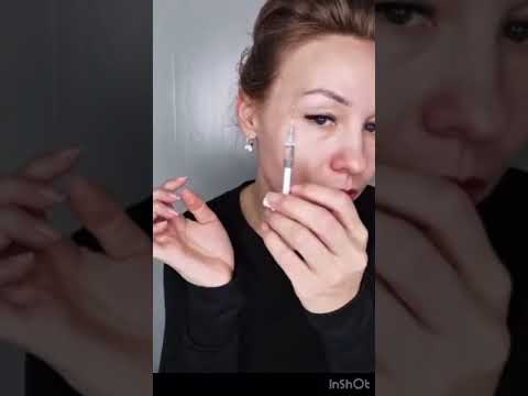 Бланширование морщин препаратом Belotero soft