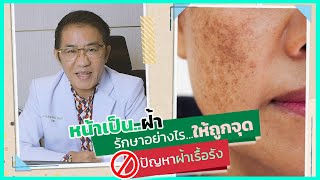 “ฝ้า”  รักษาอย่างไรให้ถูกต้อง ตรงจุด หยุดปัญหา “ฝ้าเรื้อรัง” แบบไหนก็เอาอยู่ ไม่ลอกไม่แดง หน้าไม่บาง