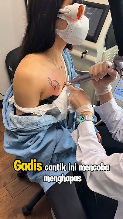 Gadis Cantik Ini Berani Hapus Tatto Di Dada Dengan Laser #videoshorts #shorts