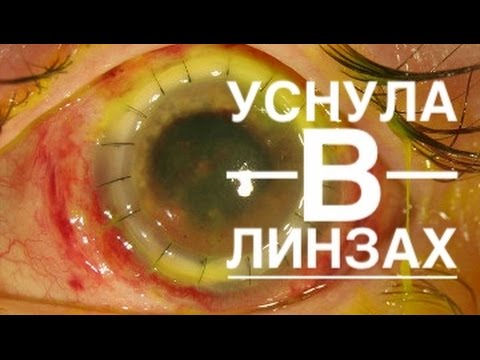 Что Если Уснуть В Линзах?