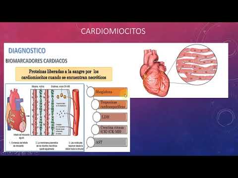 Vídeo: Enzimas Cardíacas: Valores Normales, Causas Y Más