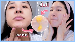 These 6 Products Help Reduce Large Pores & Dull Skin! ft. Saturday Skin