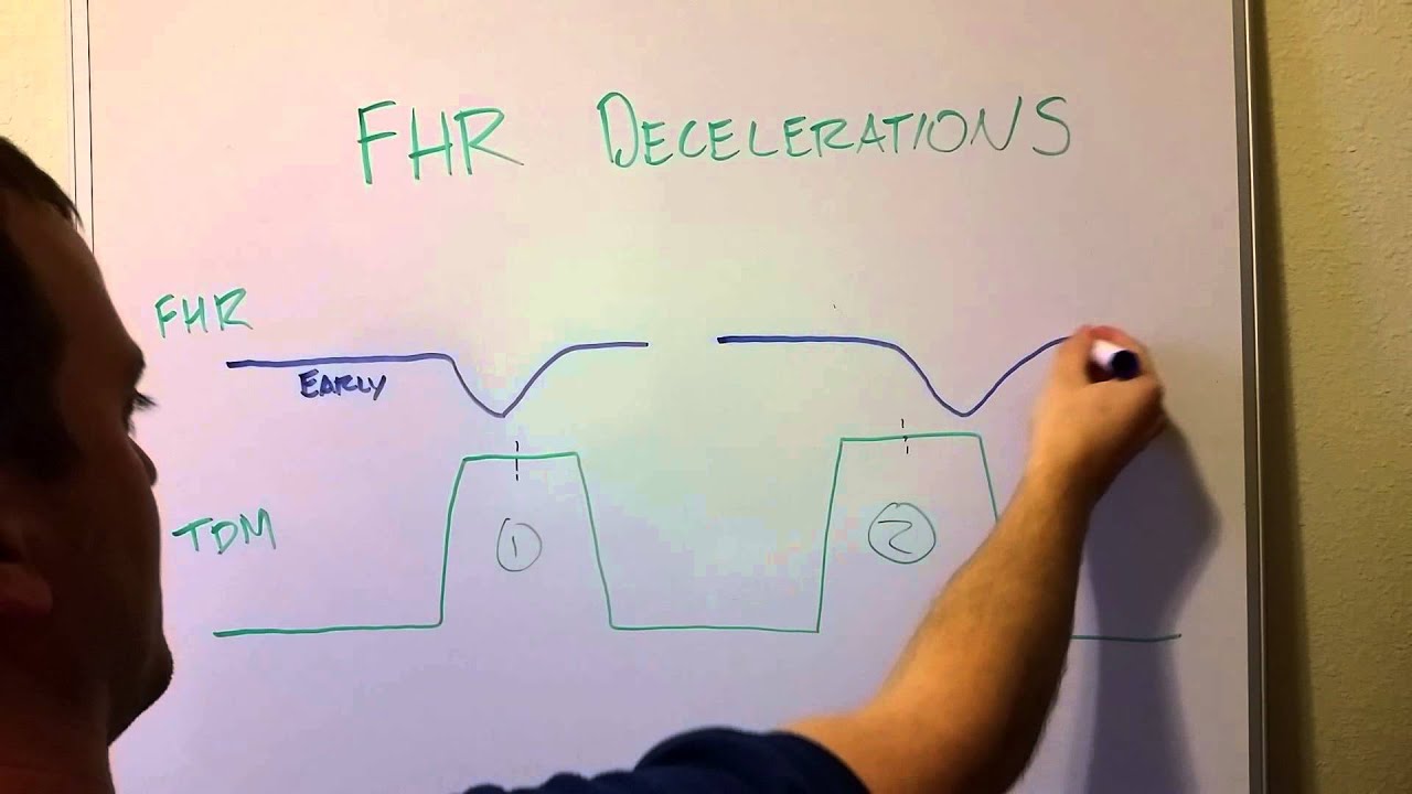 Fetal Heart Rate Decelerations Early Late Variable Youtube
