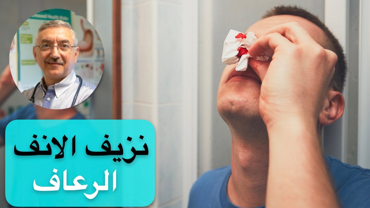 كيف تتعامل مع الرعاف أو نزيف الأنف؟ - YouTube