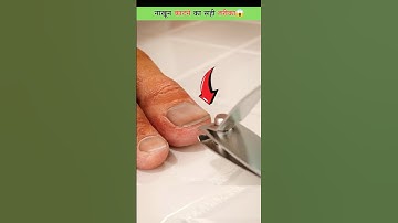 नाखून काटने का सही तरीक़ा😱