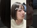 【シミ取り】スイッチルビーレーザーダウンタイム経過 #シミ取り #ダウンタイム