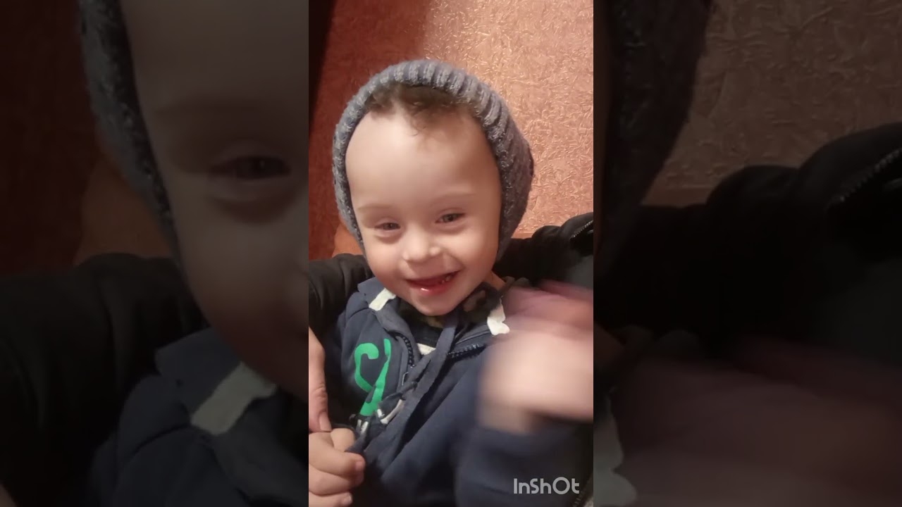 A kid with down syndrome