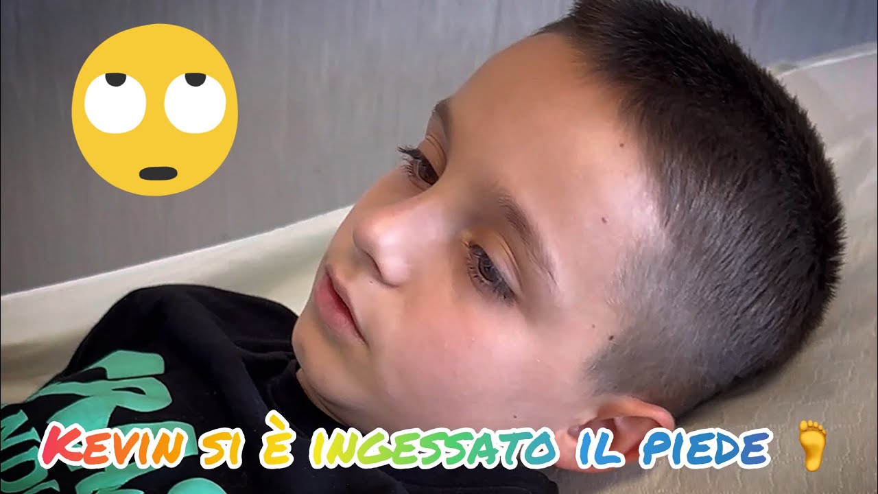 KEVIN SI È INGESSATO IL PIEDE 🦶 🤦‍♂️