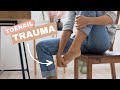 Don&#39;t Ignore Toenail Trauma: Risks and Long-term Effects - Podiatrist Georgina Tay