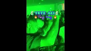 🔰TETE - ALI - TENG - TENG - Acara - Party - Remix - Jump - Viral - tik tok - Terbaru - 2025 - 2026 🔰