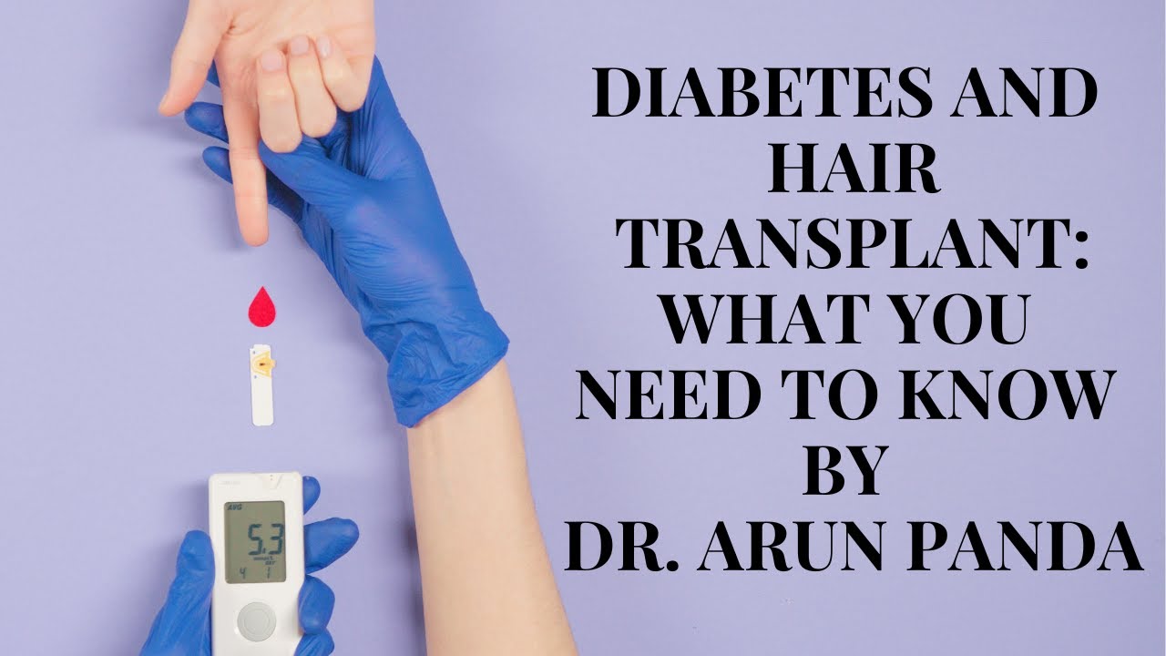 Diabetes and Hair Transplant: What You Need to Know before getting Hair Transplant