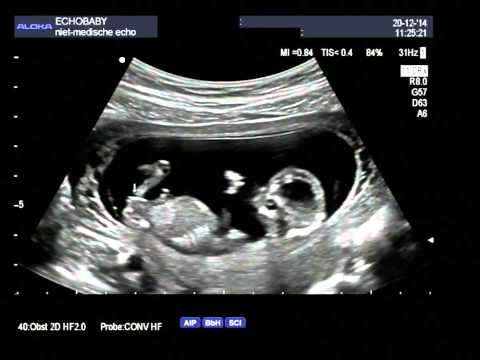 Video: Op een baby-echo?