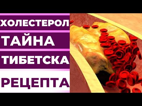 ВИСОК ХОЛЕСТЕРОЛ? ТИБЕТСКА РЕЦЕПТА ЗА ЛЕЧЕНИЕ НА ВИСОК ХОЛЕСТЕРОЛ И АТЕРОСКЛЕРОЗА!