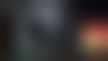 EUS-guided gastroenterostomy with hot-axios stent