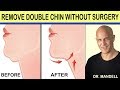 REMOVE DOUBLE CHIN WITHOUT SURGERY - Dr Alan Mandell, DC