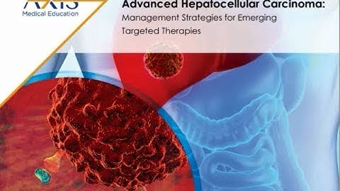 Advanced HCC - Management Strategies for Emerging Targeted Therapies