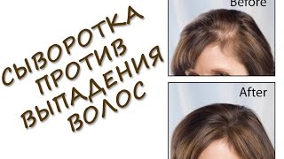 Делаем спрей против выпадения волос и для стимулирования роста волос! Делаем спрей против выпадения волос и для стимулирования роста волос!