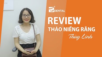 [Review niềng răng]: #5 Kết quả niềng răng của Thùy Linh