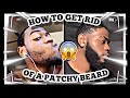 HOW TO FIX A PATCHY BEARD | PATCHY BEARD SOLUTION