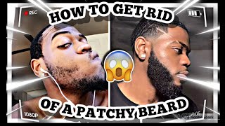 HOW TO FIX A PATCHY BEARD | PATCHY BEARD SOLUTION screenshot 3