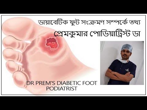 ডায়াবেটিক ফুট সংক্রমণ সম্পর্কে তথ্য - প্রেমকুমার পোডিয়াট্রিস্ট ডা | Diabetic Foot Infection