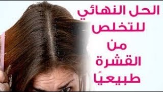 علاج قشرة الشعر نهائيا